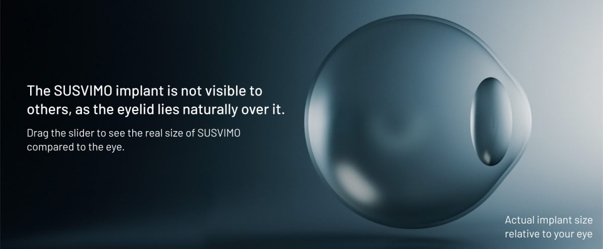 Slider infographic: Eye without implant