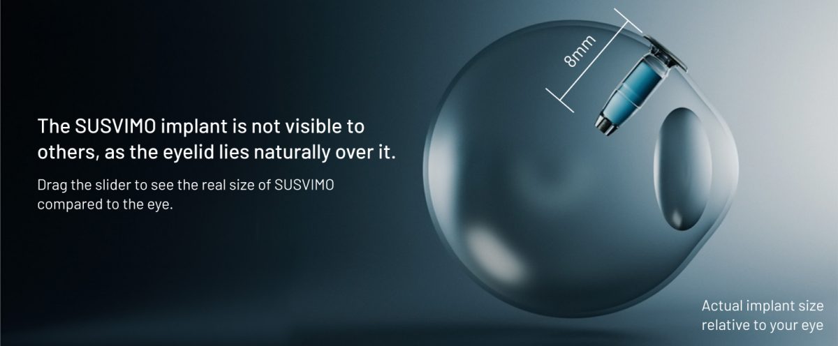 Slider infographic: Eye with implant